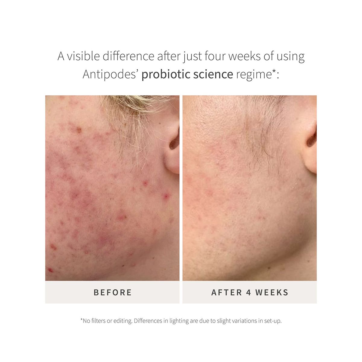 Antipodes Credo Probiotic Anti-Blemish Serum 30ml